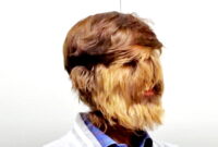 Patidar memiliki rambut di lebih dari 90 persen wajahnya, dan itu dialaminya   sejak ia masih kecil. ( Sumber : Borneobuletin.com )